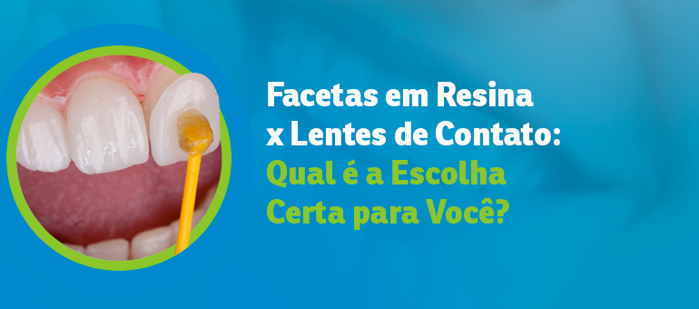 Facetas em Resina x Lentes de Contato: Qual é a Escolha Certa para Você?